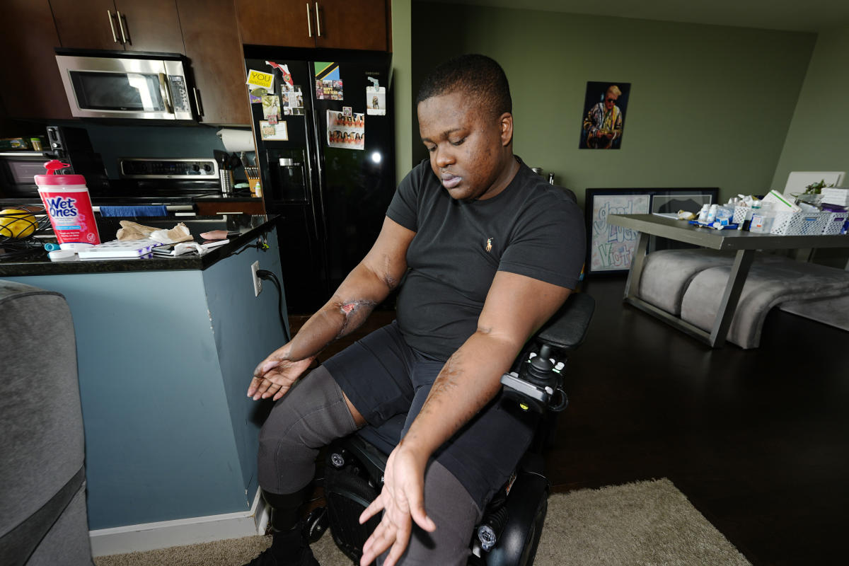 Police recruit who lost both legs in ‘barbaric hazing ritual’ sues Denver, paramedics and officers