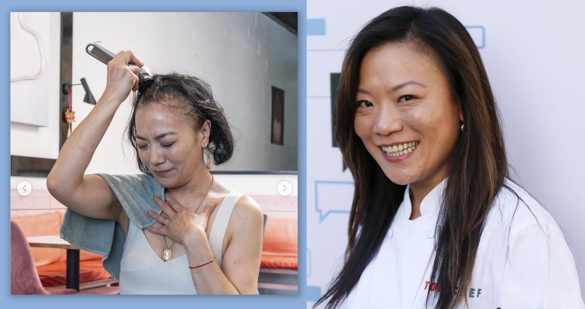 ‘Top Chef’ alum Shirley Chung was diagnosed with tongue cancer — and ‘a series of dental issues’ were her first clue something was wrong