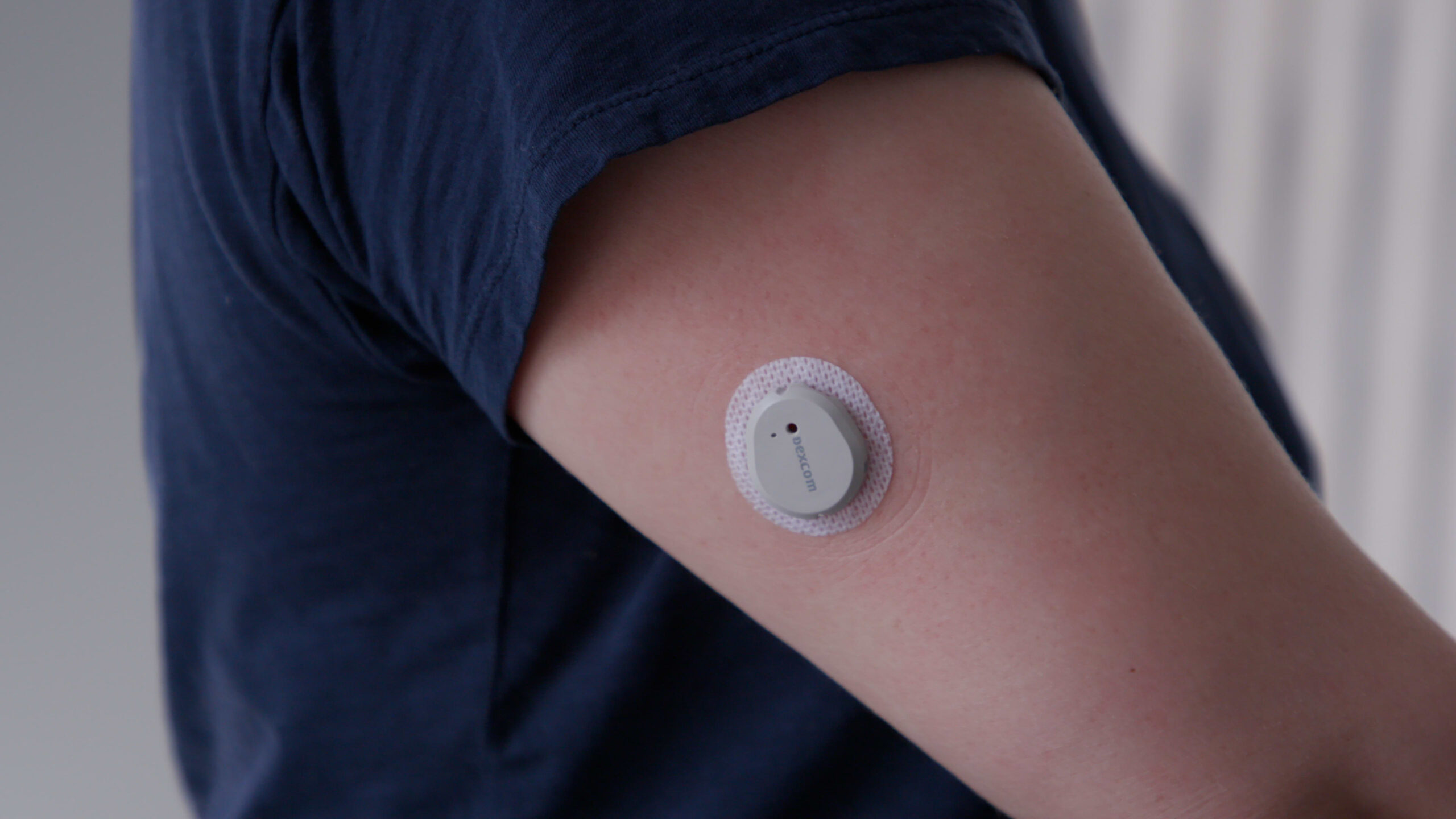 Dexcom launches first over-the-counter continuous glucose monitor. Here’s what it’s like