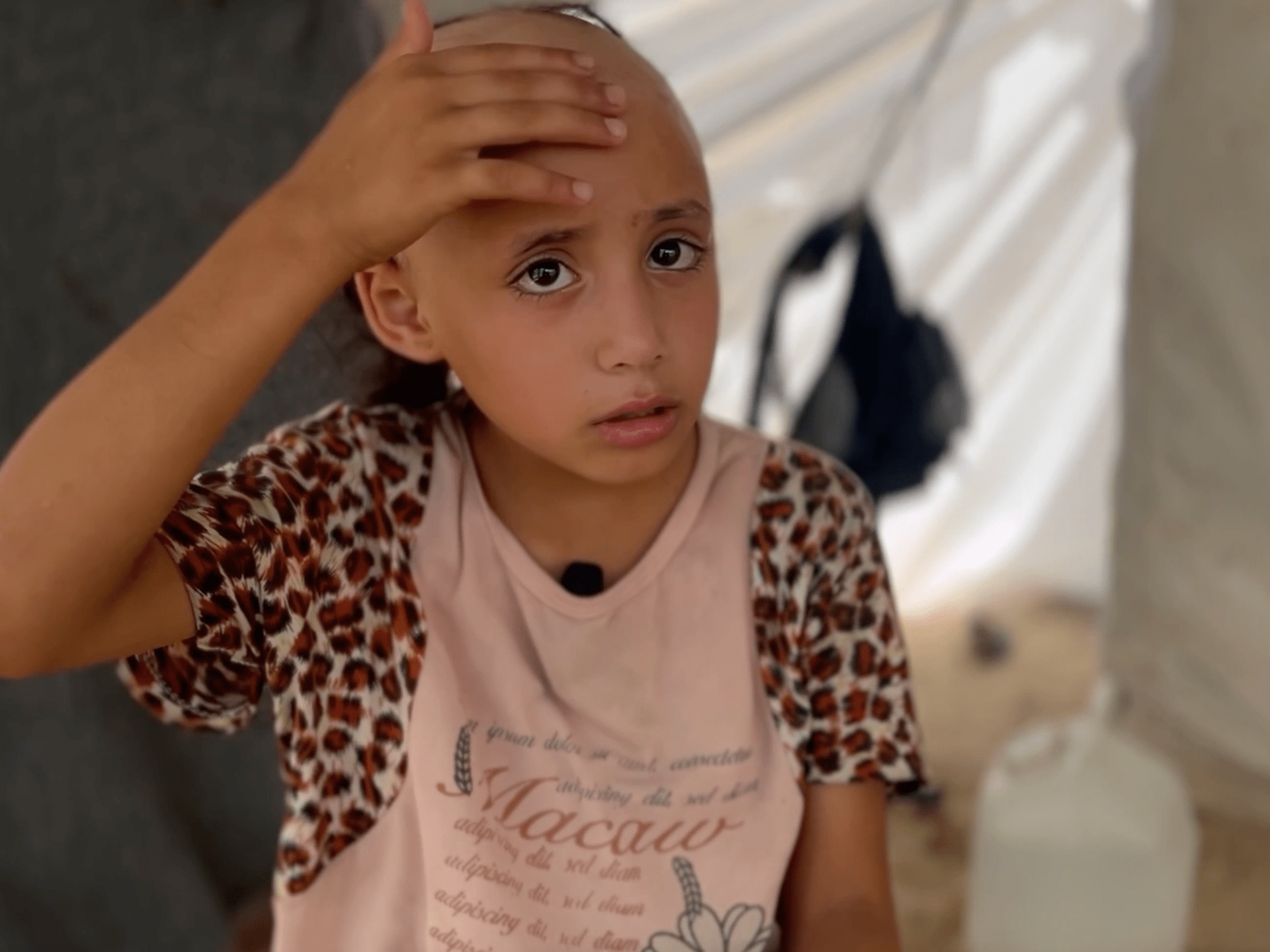 Palestinian girl describes losing her hair over war trauma