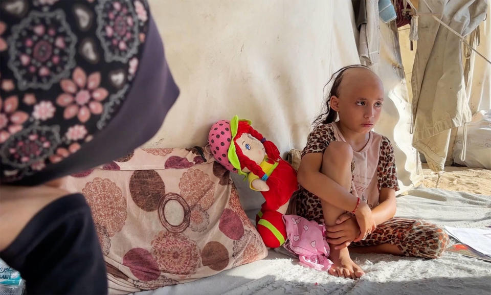 ‘Psychologically broken,’ 8-year-old Sama loses her hair