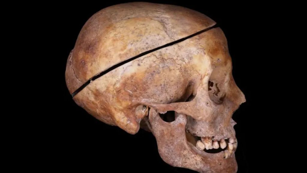 First evidence of familial embalming in Europe dates back to 16th century: Study