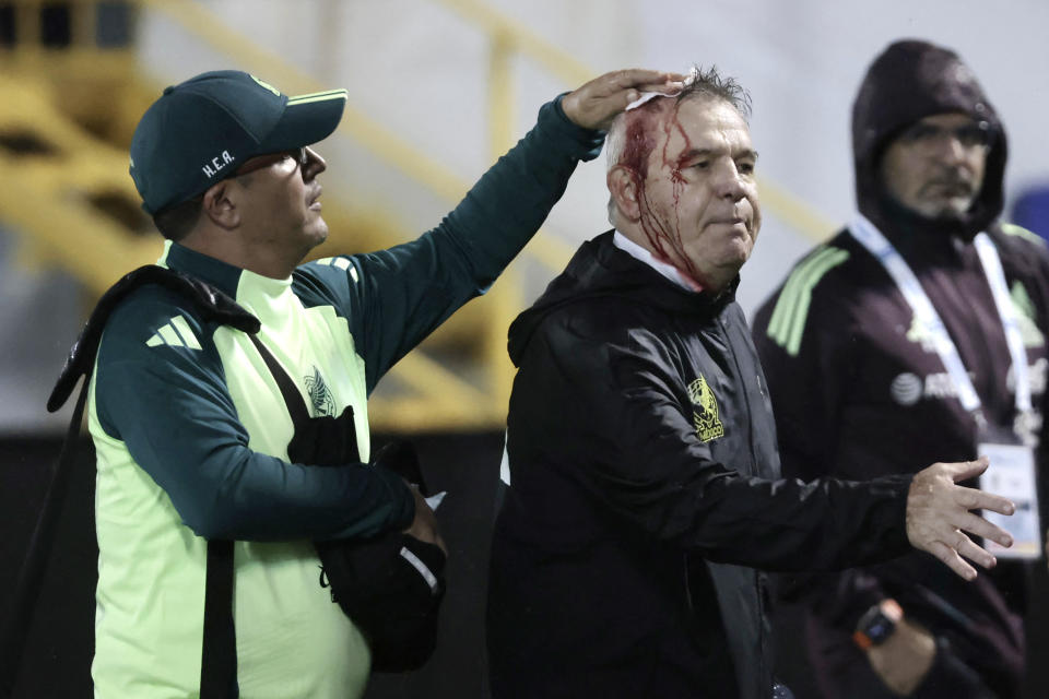 Mexico manager Javier Aguirre bloodied after being hit with beer can following loss to Honduras