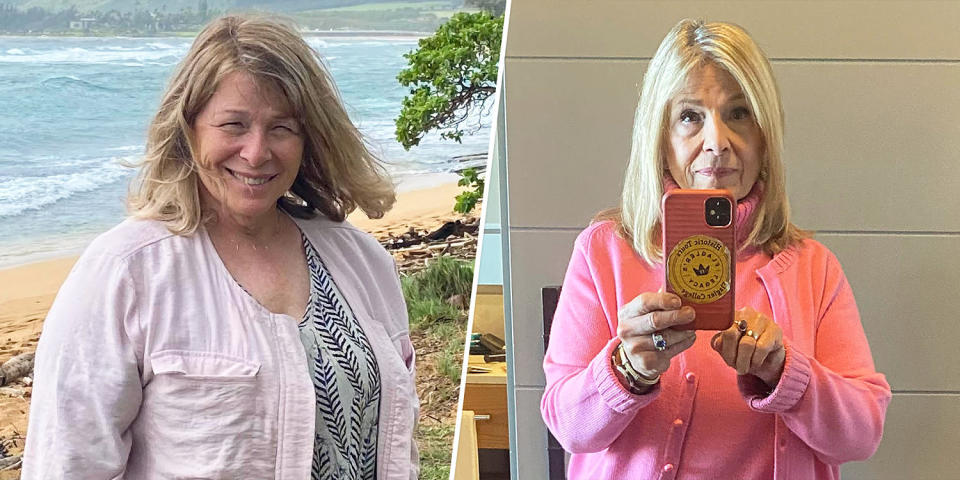 Ozempic before and after: 5 women get real about weight loss, side effects and cost